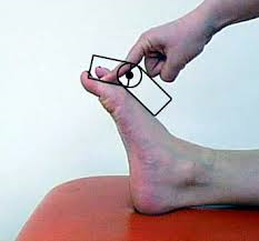 Foot Assessment - Foot, Ankle & Lower Leg Orthopedic Assessment